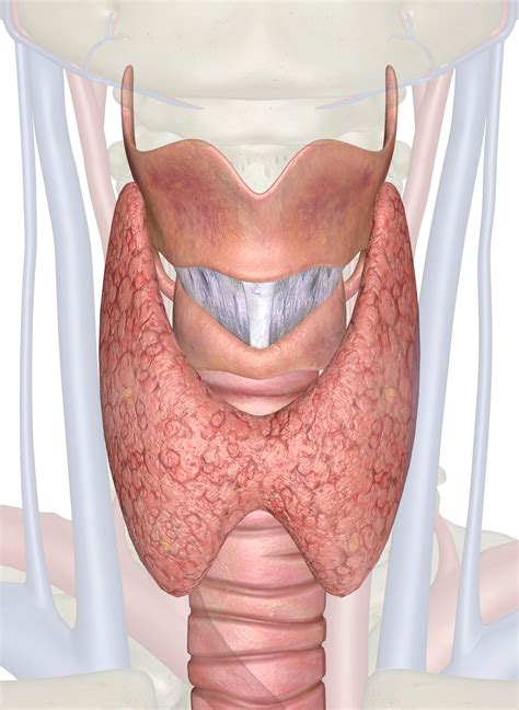Thyroid Gland Test Identifies Thyroid Nodules That Don't Require