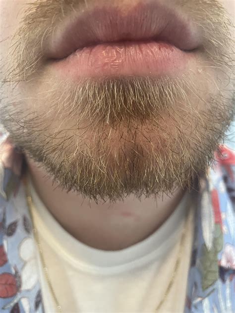 Dry skin around nose piercing : r/piercing