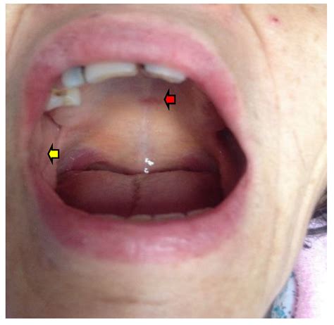 Metabolic Abnormalities In Addison's Disease Include at Douglas Sexton blog