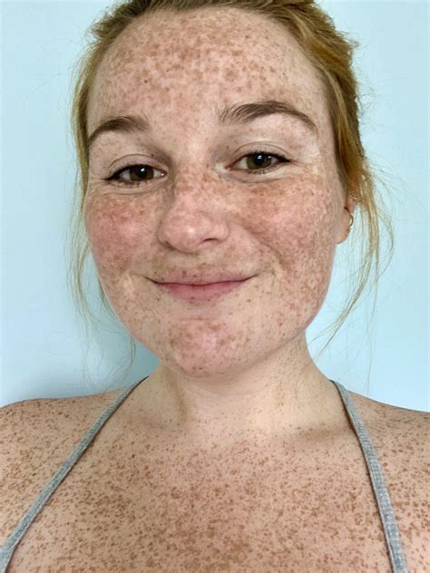 I went to the beach and got LOTS of new freckles :) : r/FreckledGirls