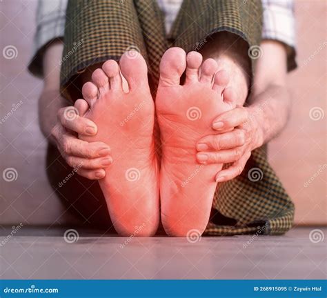 Tingling and Burning Sensation in Foot of Asian Man. Foot Pain. Sensory Neuropathy Problems ...