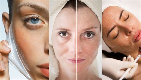 Skin Peeling Inside Mouth: Causes, Symptoms, and Treatment