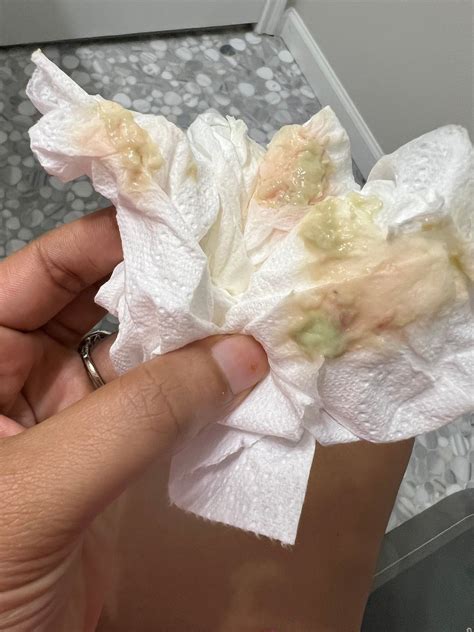 Green discharge in 2025 | Green, Pregnancy months, What next