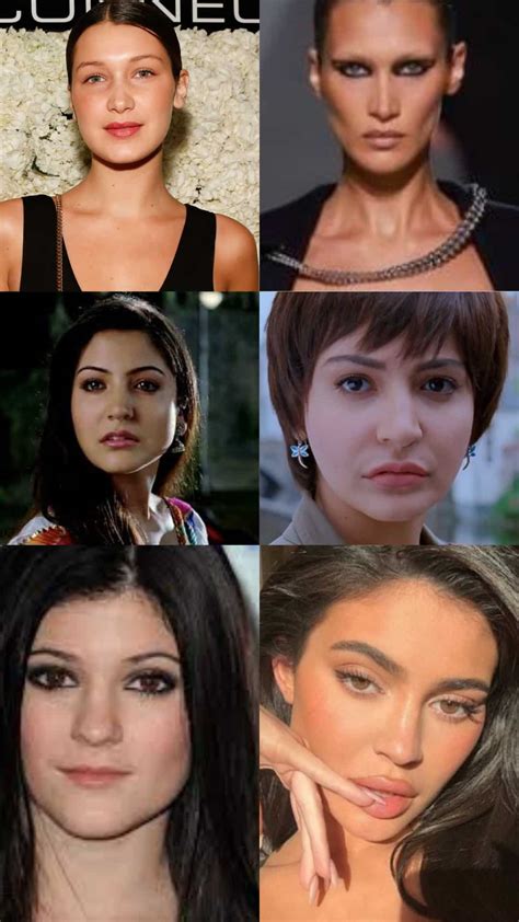 Celebrity plastic surgery - 10 before and after images
