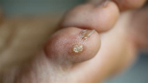 Videos | Page 50 of 215 | NutritionFacts.org