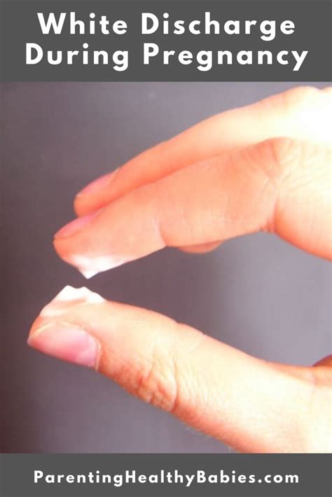 Is White Discharge an Early sign of Pregnancy? | Pregnancy signs, Early ...