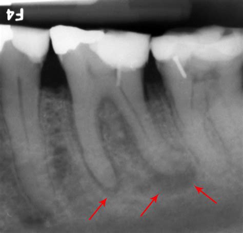 Dental Abscess X Ray Dog at Layla Helms blog