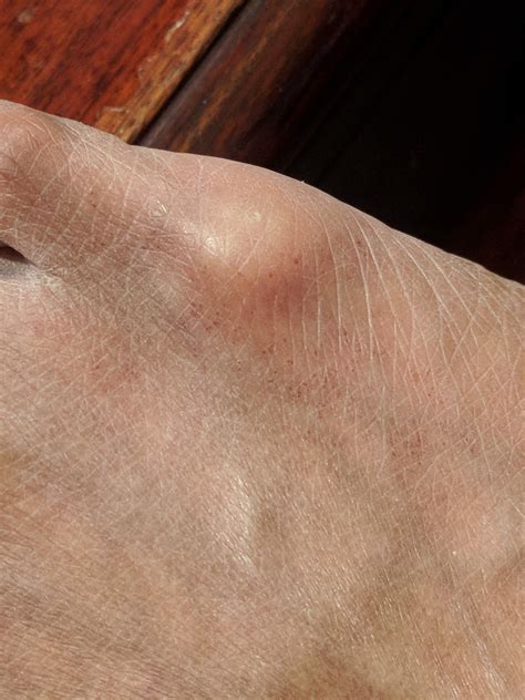 Caterpillar Vs Asp at Tracey Luther blog