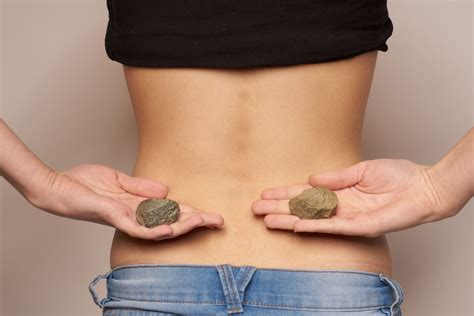 4 Stages Of Passing A Kidney Stone: Know The Details Here! - He and She Fitness