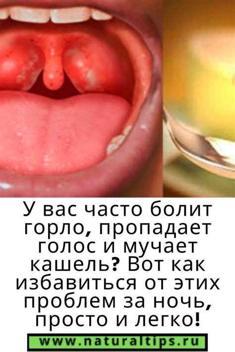 Что делать если пропал голос и горло уже не болит народные средства