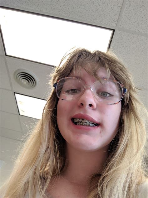 AhhhhhHhHHhH | Braces girls, Cute braces, Female dentist