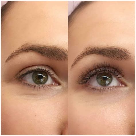 Eyelashes Falling Out