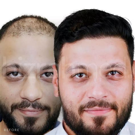 Ivanka Trump's Stunning Transformation: A Deep Dive into Cosmetic ...