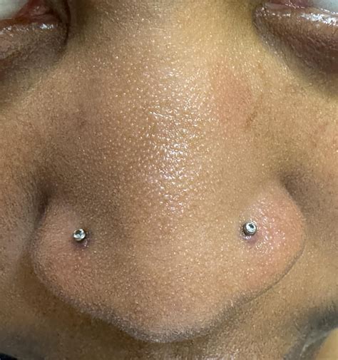 Keep getting nose piercing bumps : r/piercing