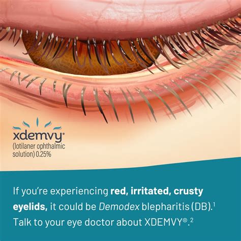 Dr Iravani shares her experience helping patients treat their red ...