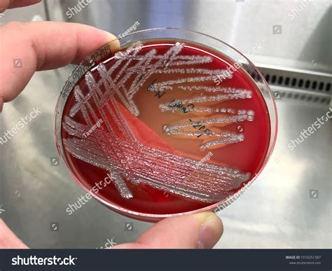 Agar Pseudomonas Aeruginosa Emb