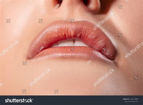 Asymmetry Lips Seals Bumps Lips After Stock Photo 1266573880 | Shutterstock