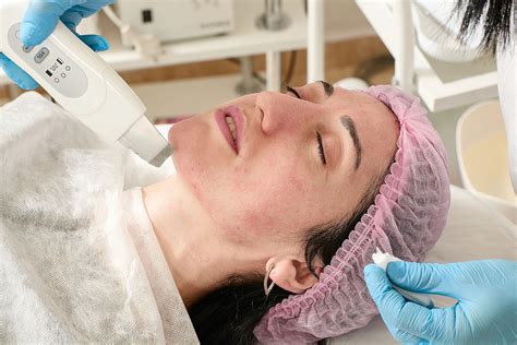 Dermaplaning Results: What to Expect Before and After Your Treatment