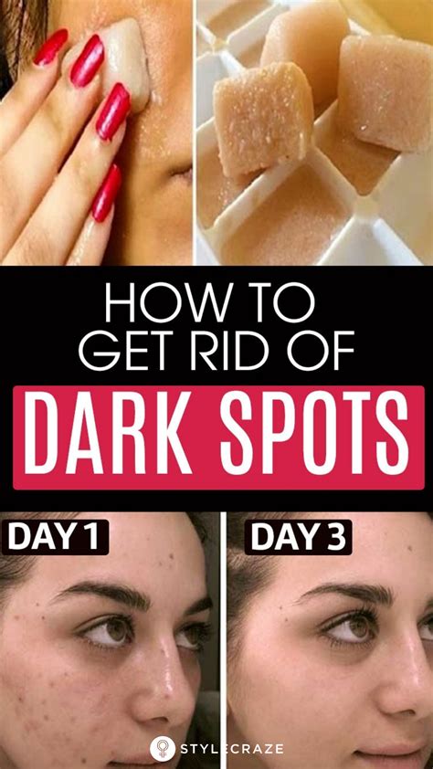 Dark spots