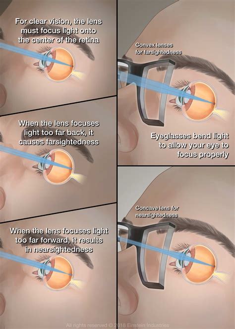 How Do Glasses Work Bbc Bitesize at Douglas Wilder blog