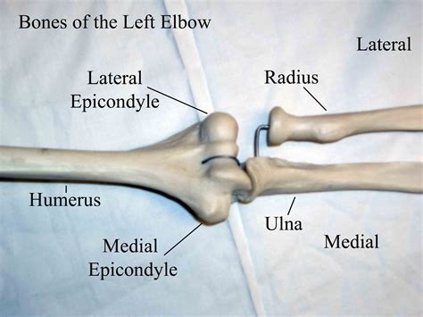 Common musculoskeletal assessments and injuries of the elbow. | Elbow anatomy, Anatomy bones ...