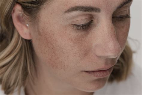 Does Sunscreen Prevent Tanning? | Eucerin