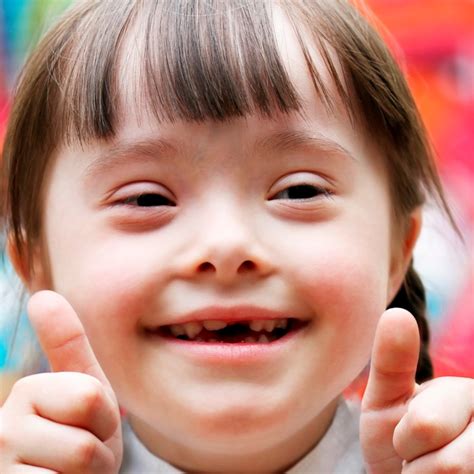 What Syndrome Do Dwarfs Have? Exploring Conditions And Patterns
