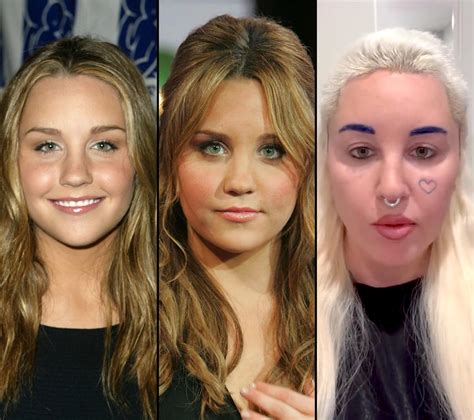 Amanda Bynes Plastic Surgery Breast