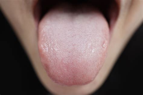 What Do Taste Buds Look Like On Your Tongue at Elnora Hagy blog