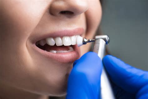 The Disadvantages of Deep Cleaning Teeth You Should Know
