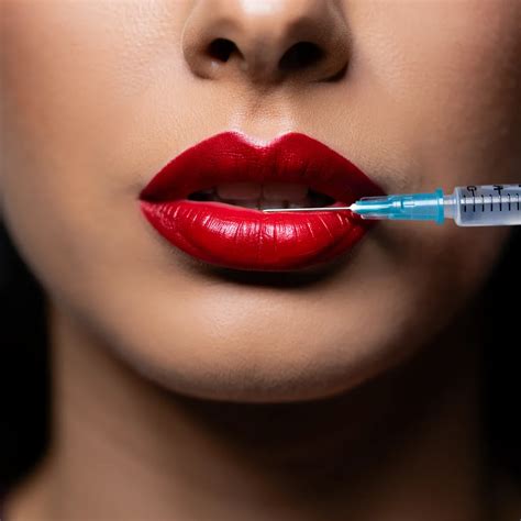 Advanced Lip Filler Techniques in Berkeley, CA - October 5, 2025 ...