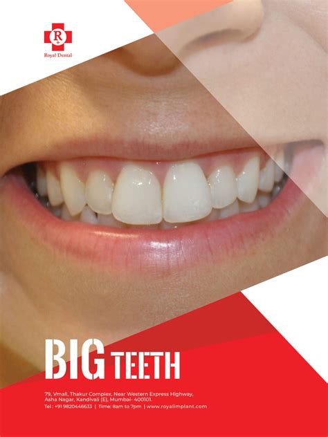 What Are Solutions To Big Teeth? - Royal Dental Clinics Blog