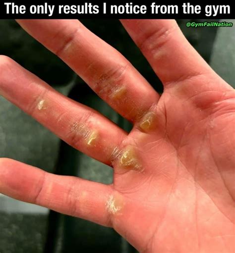 My hands always look like this : r/GymMemes