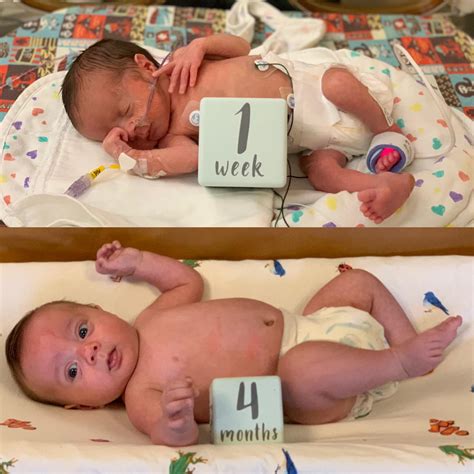 Baby Born At 30 Weeks Survival Rate