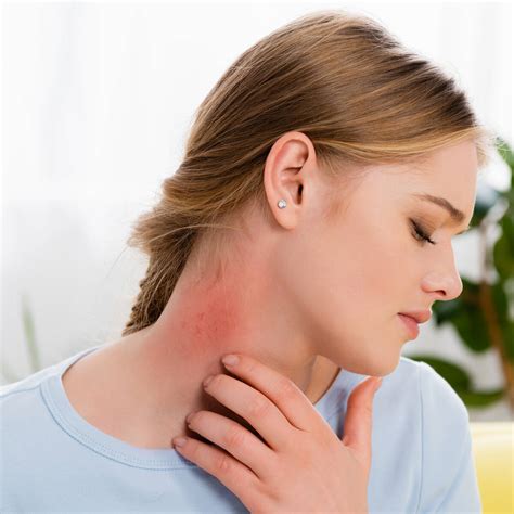Rashes On Neck