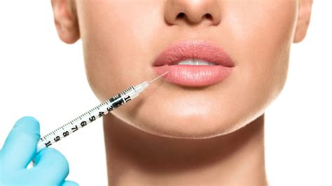 Filler labbra: Lip Injection Techniques - Medicina Estetica dott.ssa ...