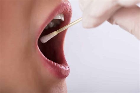 What Is A Good PH Of Saliva In Your Mouth?