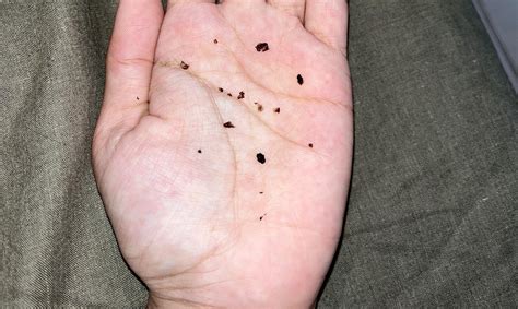 Cat Has Little Black Specks In Her Fur at Lachlan Legge blog