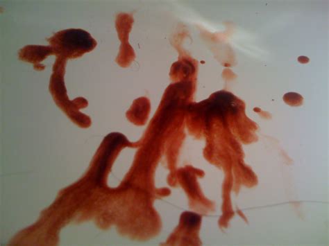 Is There a Color or Feature of Semen that Can Mean Cancer? » Scary Symptoms