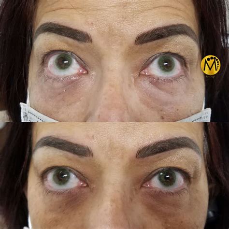 Brazilian Camouflage | Mussa Beauty Studio