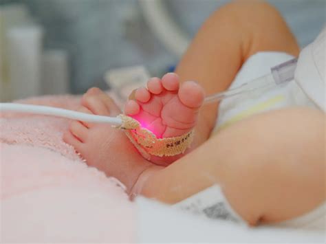 Types of Screening | Newborn Screening Ontario