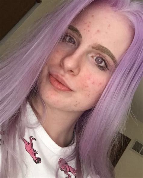 I'm an albino with purple eyes – people say I look like an 'angel' or ...