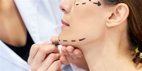 Thread Lift Surgery Cost & Procedure | Non-Surgical Face Lift