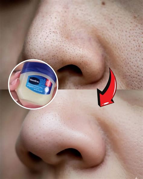 Vaseline In Nose