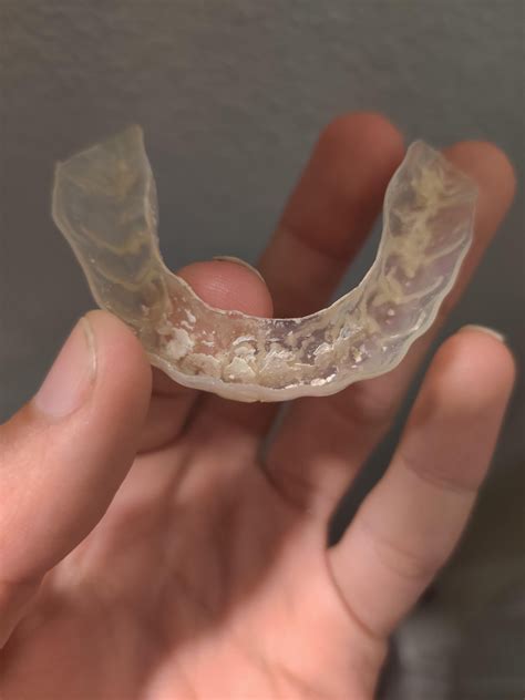 Does anyone have any clue what this thing in my mouth is? It has just ...