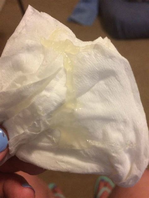 Mucus Plug FAQs for First Time Moms