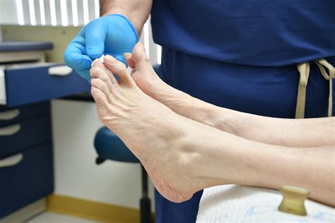 Bunion Surgery Recovery: What To Expect and How To Prepare — Snug Safety