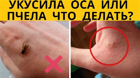 Что делать если укусила ос. Укус осы в домашних условиях. Помощь при ...