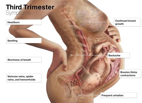 Braxton Hicks Diagram