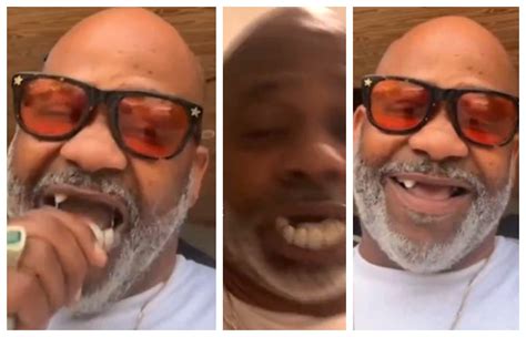 Damon Dash Addresses His TEETH Falling Out on Live Chat / Reveals ...